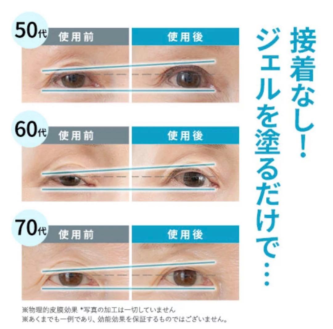 【リッドキララ 】まぶた整形ジェル10g✖️２本 北の快適工房 新品未使用
